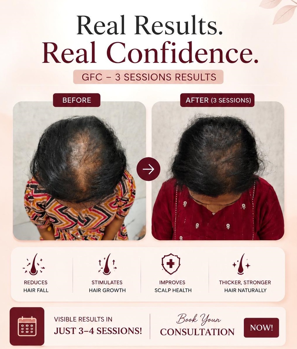Best hair transplant clinic in chennai